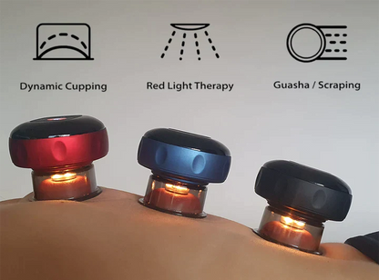 SmartCup suction cup